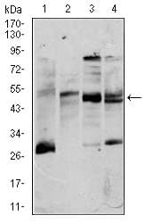 CD5 Antibody (clone 6A11)