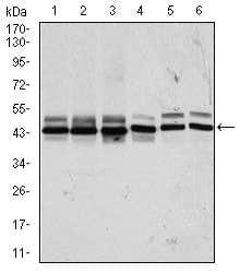 Monoclonal Mouse anti-Human CSNK2A2 Antibody (clone 10, IHC, WB)