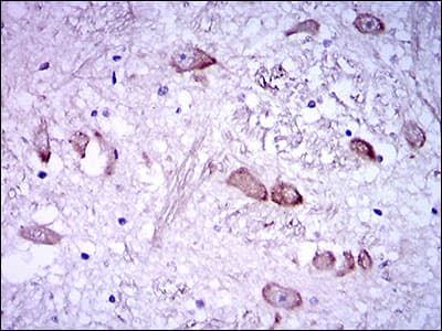 rnfH Antibody (clone 8H10)
