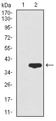 Monoclonal Mouse anti-Human CD59 Antibody (clone 8D2B8, IHC, IF, WB)