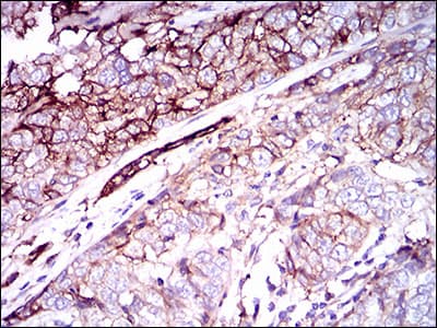 Monoclonal Mouse anti-Human CD59 Antibody (clone 8D2B8, IHC, IF, WB)