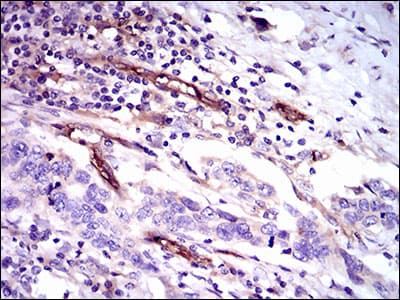 Monoclonal Mouse anti-Human CD59 Antibody (clone 8D2B8, IHC, IF, WB)