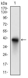 CD74 / CLIP Antibody (aa1-106, clone 2D1B3)