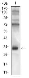 CD74 / CLIP Antibody (aa1-106, clone 2D1B3)