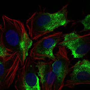 CD74 / CLIP Antibody (aa1-106, clone 2D1B3)