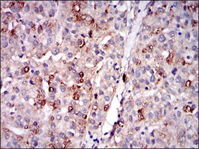 Monoclonal Mouse anti-Human PLIN2 / ADFP / Adipophilin Antibody (clone 2C5A3, aa286-437, IHC, WB)