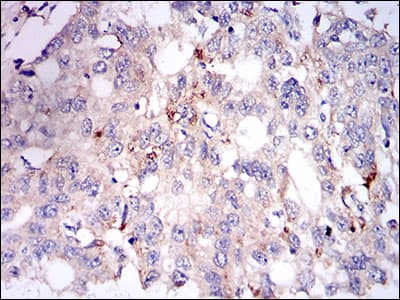 Monoclonal Mouse anti-Human PLIN2 / ADFP / Adipophilin Antibody (clone 2C5A3, aa286-437, IHC, WB)