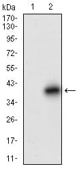 Monoclonal Mouse anti-Human DCN / Decorin Antibody (clone 1G4C5, aa263-324, WB)