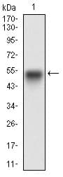 Monoclonal Mouse anti-Human EGFR Antibody (clone 7A6F12, aa693-893, IHC, WB)