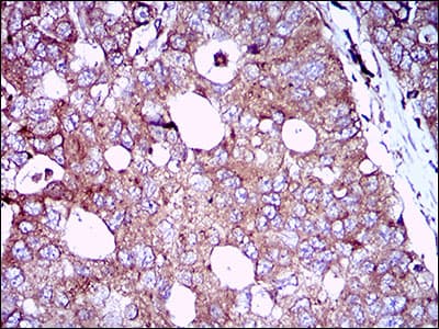 Monoclonal Mouse anti-Human EGFR Antibody (clone 7A6F12, aa693-893, IHC, WB)