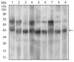 Monoclonal Mouse anti-Human MAPK14 / p38 Antibody (clone 10B11C8, aa299-360, IHC, WB)