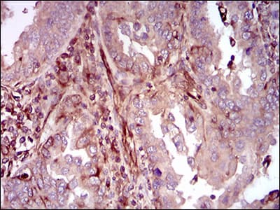 Monoclonal Mouse anti-Human MAPK14 / p38 Antibody (clone 10B11C8, aa299-360, IHC, WB)