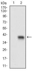Monoclonal Mouse anti-Human C1qRP / CD93 Antibody (clone 1A10E10, aa474-535, IHC, IF, WB)