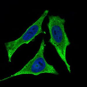 Monoclonal Mouse anti-Human C1qRP / CD93 Antibody (clone 1A10E10, aa474-535, IHC, IF, WB)
