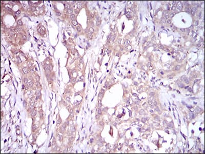 Monoclonal Mouse anti-Human C1qRP / CD93 Antibody (clone 1A10E10, aa474-535, IHC, IF, WB)