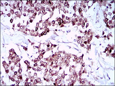 Monoclonal Mouse anti-Human SOX10 Antibody (clone 2E7E8, aa147-252, IHC, WB)