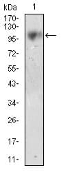Monoclonal Mouse anti-Human MME / CD10 Antibody (clone 7D4B1, aa52-246, IHC, WB)