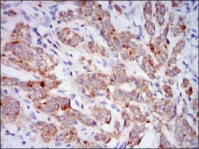 Monoclonal Mouse anti-Human MME / CD10 Antibody (clone 7D4B1, aa52-246, IHC, WB)