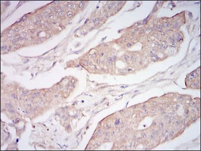 MME / CD10 Antibody (aa52-246, clone 5E9A5)