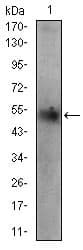PLIN2 / ADFP / Adipophilin Antibody (aa286-437, clone 2C5H8)