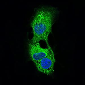 PLIN2 / ADFP / Adipophilin Antibody (aa286-437, clone 2C5H8)