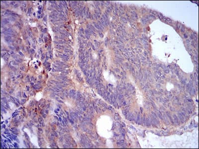 PLIN2 / ADFP / Adipophilin Antibody (aa286-437, clone 2C5H8)