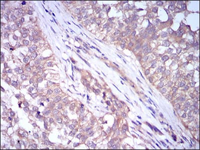 PLIN2 / ADFP / Adipophilin Antibody (aa286-437, clone 2C5H8)