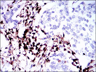 Monoclonal Mouse anti-Human CD45 / LCA Antibody (clone 5D3A3, aa928-989, IHC, WB)