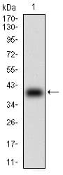 Monoclonal Mouse anti-Human B2M / Beta 2 Microglobulin Antibody (clone 3G5H8, aa21-100, IHC, WB)