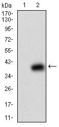 Monoclonal Mouse anti-Human B2M / Beta 2 Microglobulin Antibody (clone 3G5H8, aa21-100, IHC, WB)