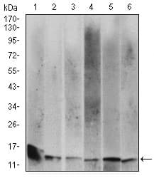 Monoclonal Mouse anti-Human B2M / Beta 2 Microglobulin Antibody (clone 3G5H8, aa21-100, IHC, WB)