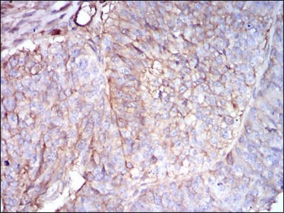 Monoclonal Mouse anti-Human B2M / Beta 2 Microglobulin Antibody (clone 3G5H8, aa21-100, IHC, WB)