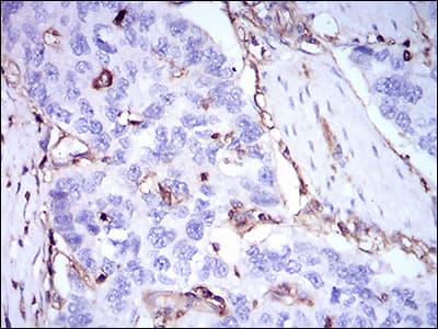 Monoclonal Mouse anti-Human B2M / Beta 2 Microglobulin Antibody (clone 3G5H8, aa21-100, IHC, WB)