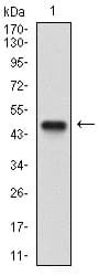 NBN / Nibrin Antibody (aa467-615, clone 7E4C2)