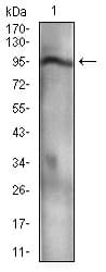 NBN / Nibrin Antibody (aa467-615, clone 7E4C2)