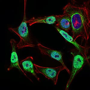 NBN / Nibrin Antibody (aa467-615, clone 7E4C2)
