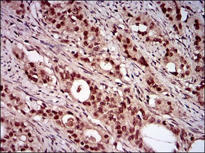 NBN / Nibrin Antibody (aa467-615, clone 7E4C2)