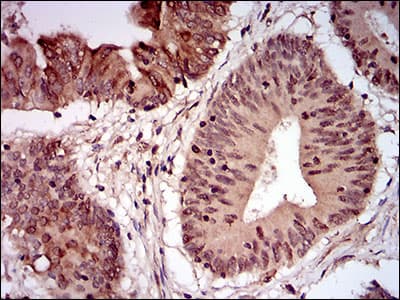 NBN / Nibrin Antibody (aa467-615, clone 7E4C2)