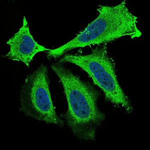 BDNF Antibody (aa19-248, clone 3D9C5)