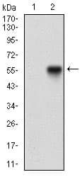 NBN / Nibrin Antibody (aa467-615, clone 7E4A2)