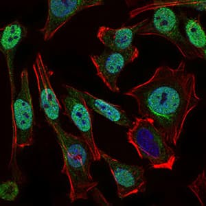 NBN / Nibrin Antibody (aa467-615, clone 7E4A2)