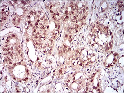NBN / Nibrin Antibody (aa467-615, clone 7E4A2)