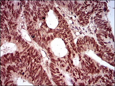 NBN / Nibrin Antibody (aa467-615, clone 7E4A2)