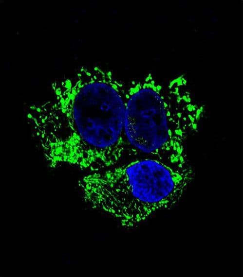 ALDH2 Antibody