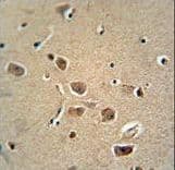 Monoclonal Mouse anti-Rat SERPINH1 / HSP47 Antibody (aa222-251, IHC, WB)