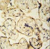 Polyclonal Rabbit anti-Human CLIC6 Antibody (aa539-565, IHC, WB)