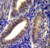 Polyclonal Rabbit anti-Human CNN2 Antibody (aa9-36, IHC, WB)