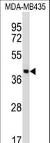 Polyclonal Rabbit anti-Human SFTPD / Surfactant Protein D Antibody (aa301-330, WB)