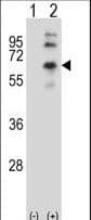 Polyclonal Rabbit anti-Human CHRM2 / M2 Antibody (aa336-364, WB)