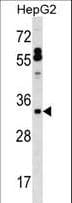 Polyclonal Rabbit anti-Human SFTPB / Surfactant Protein B Antibody (aa129-158, WB)